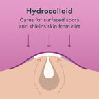 Rael Acne Pimple Patches