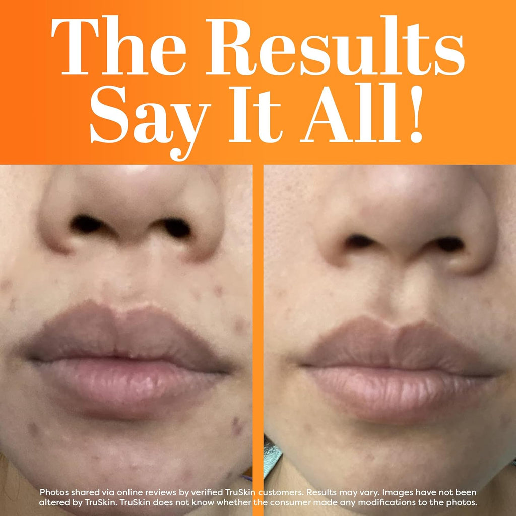 TruSkin Vitamin C Face Serum