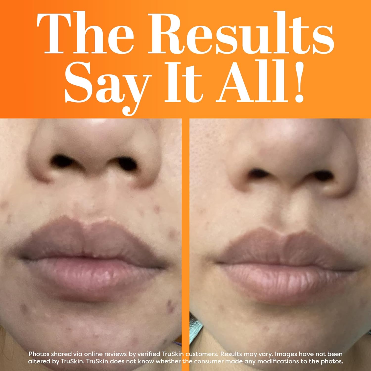 TruSkin Vitamin C Face Serum