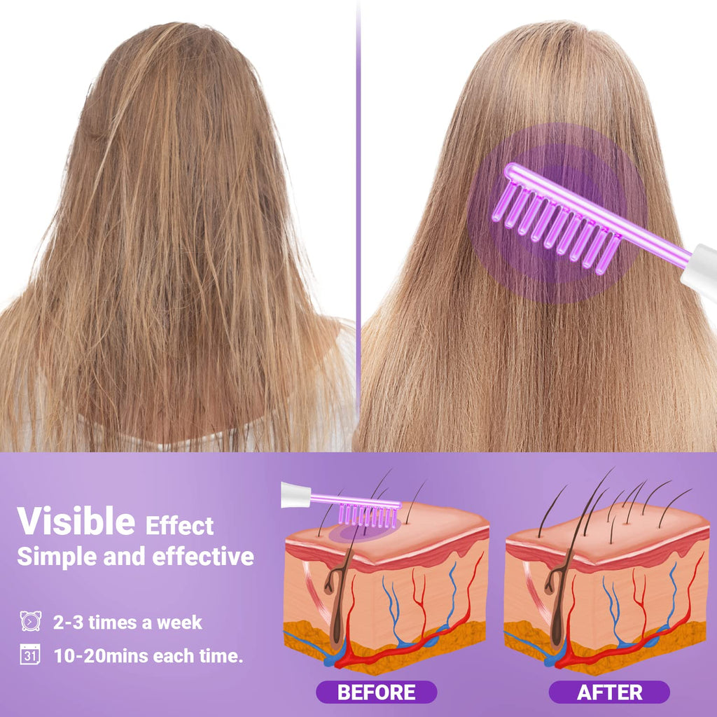 High Frequency Facial Wand